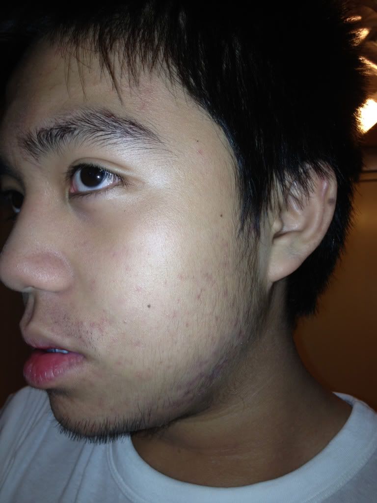 Why am i growing facial hair Ultra pornstar cheerleaders